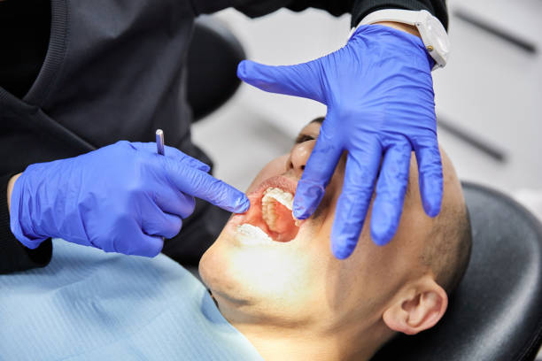 Best Chipped Tooth Repair Near Me  in Mansfield, OH